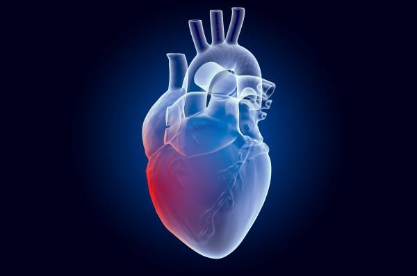 اسکن قفسه سینه می تواند ناراحتی قلبی را هم تشخیص دهد